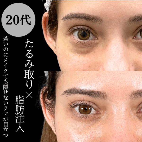 No.16728の症例写真